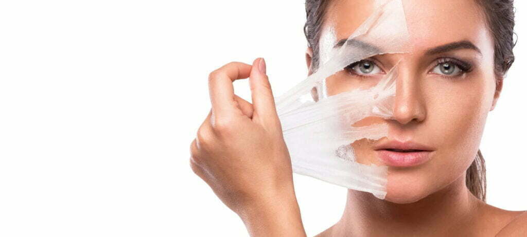 Peeling Químico